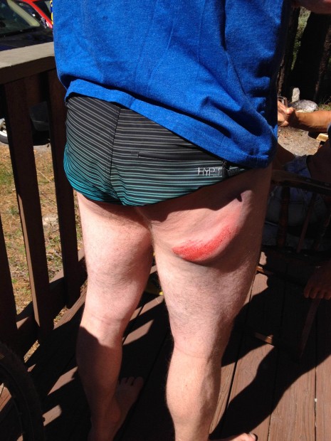 Don't fall on rocks
