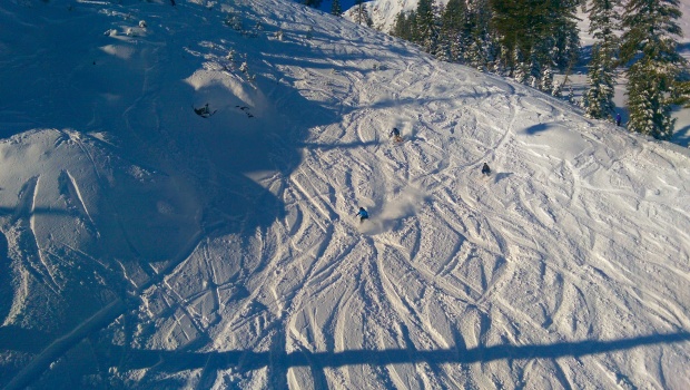 Top of the face