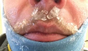 Check your nose, and your facial hair!