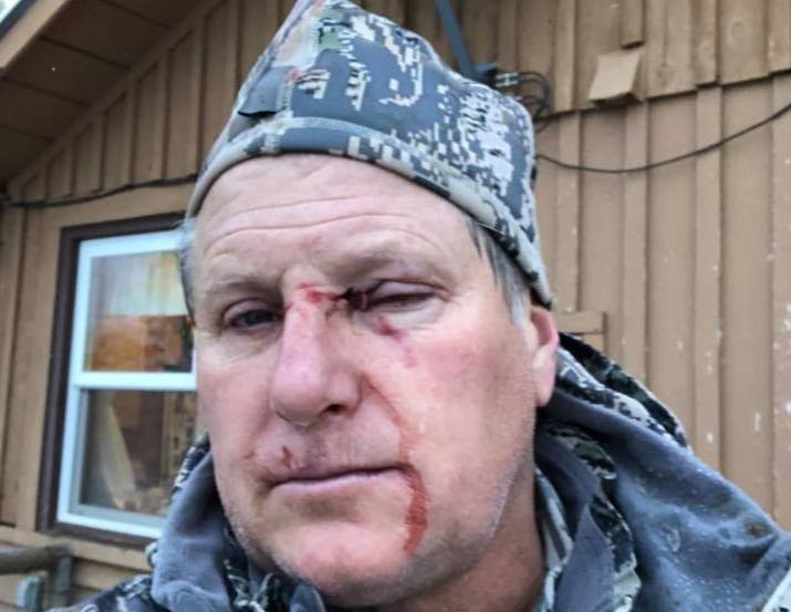 bow hunters, elk, grizzly, attack, bear attack, montana