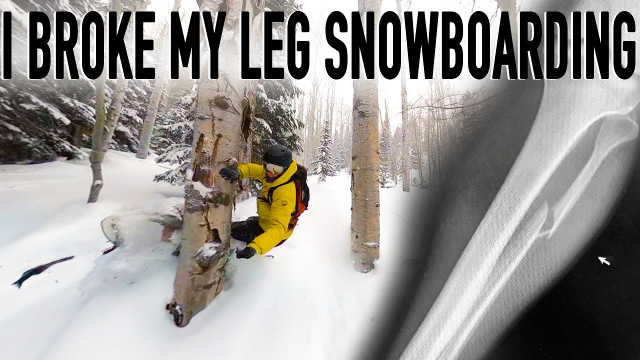 snowboarder, broken leg,