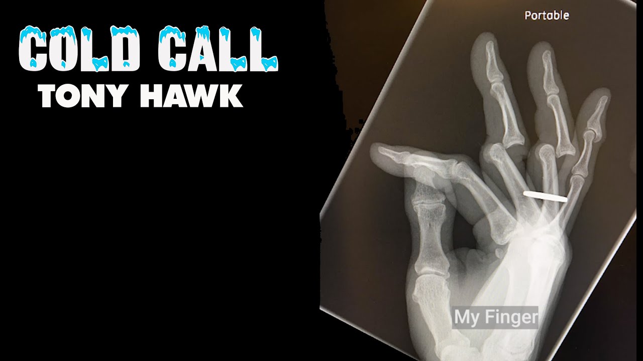 Tony Hawk