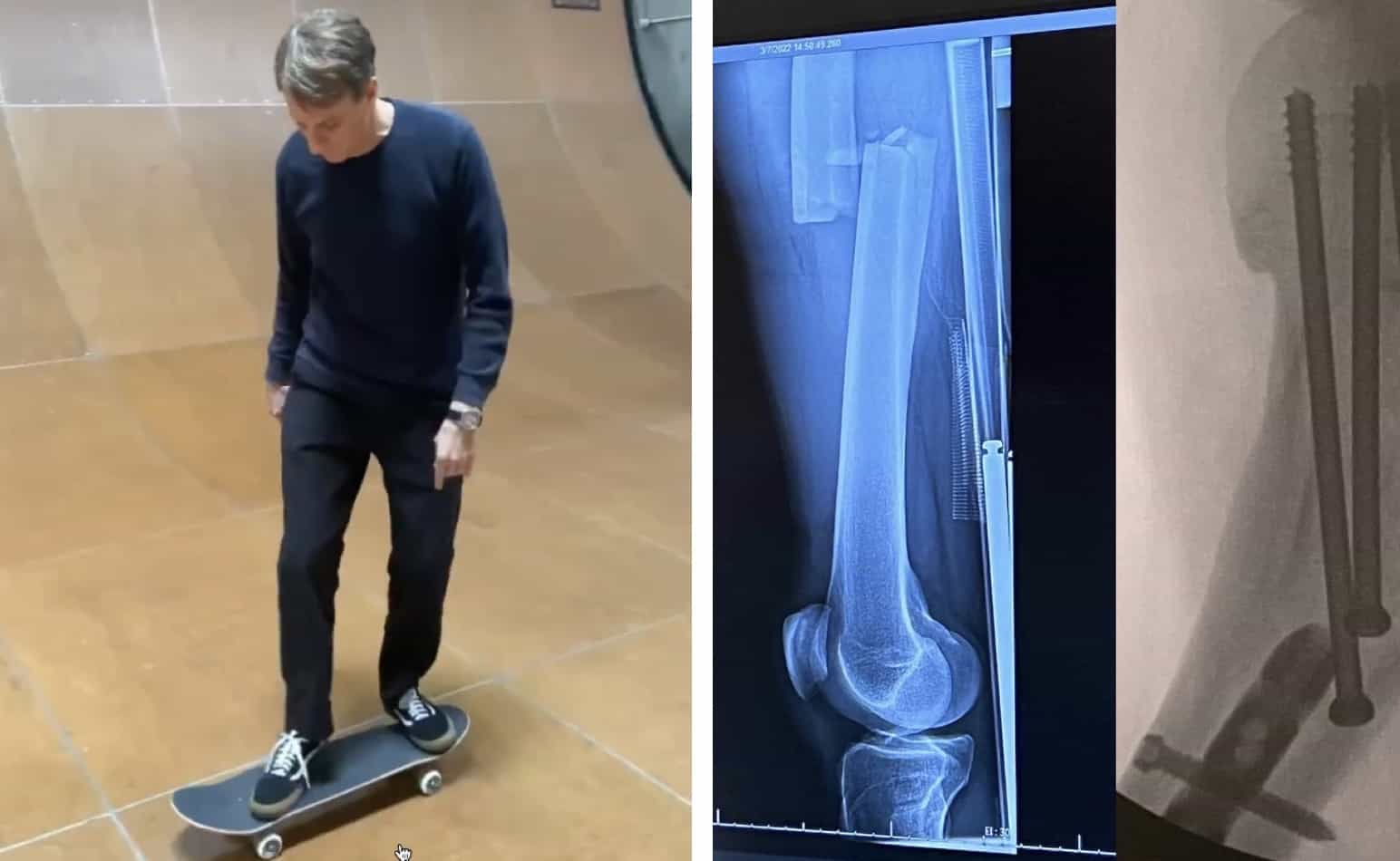 Tony hawk