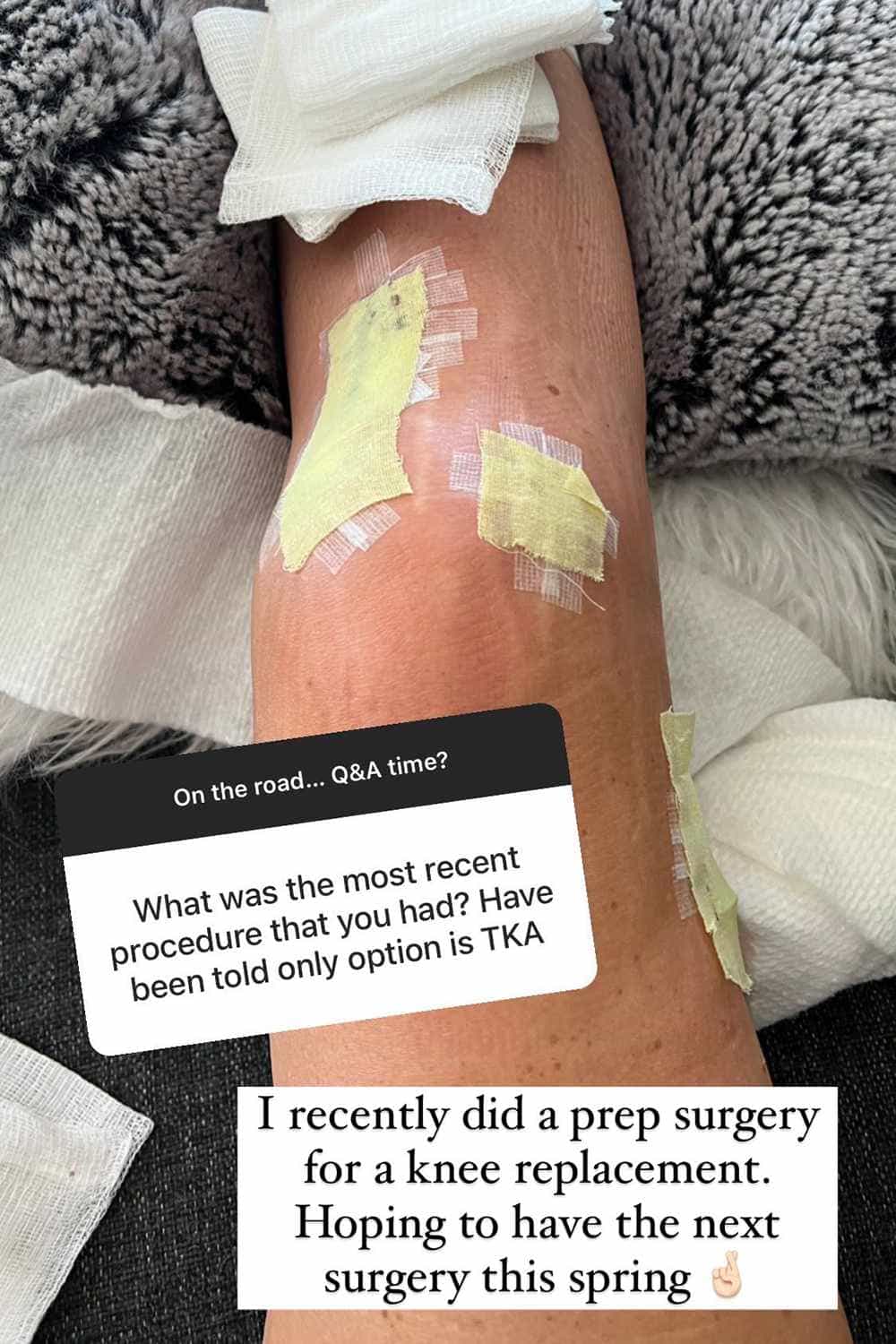 Lindsey Vonn knee replacement