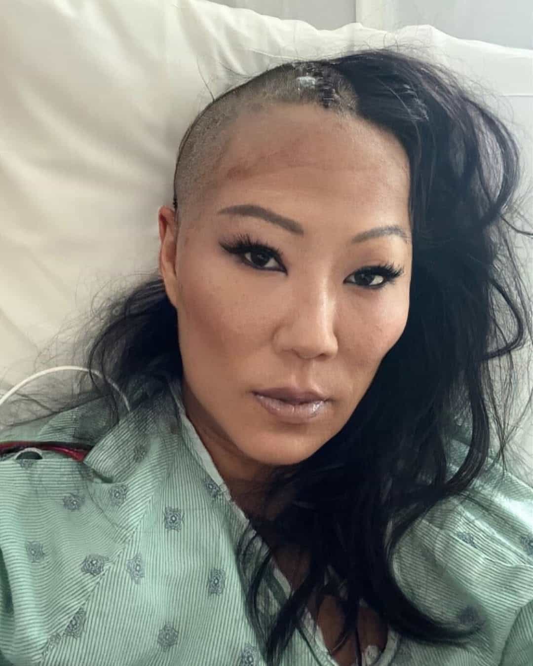 Lynn Ban post op | Photo: Lynn Ban Instagram